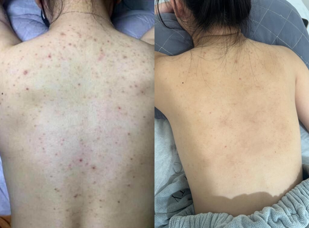 SKS Mall美背推荐